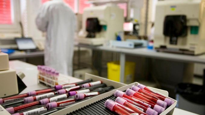 Laboratoř ve švýcarském Lausanne: Právě tady se testují vzorky odebrané sportovcům na přítomnost zakázaných látek.