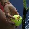 US Open 2015, detaily: Dominika Cibulková