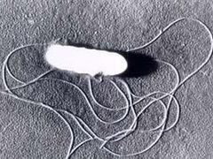 Baktérie Listeria monocytogenes v elektronovém mikroskopu.