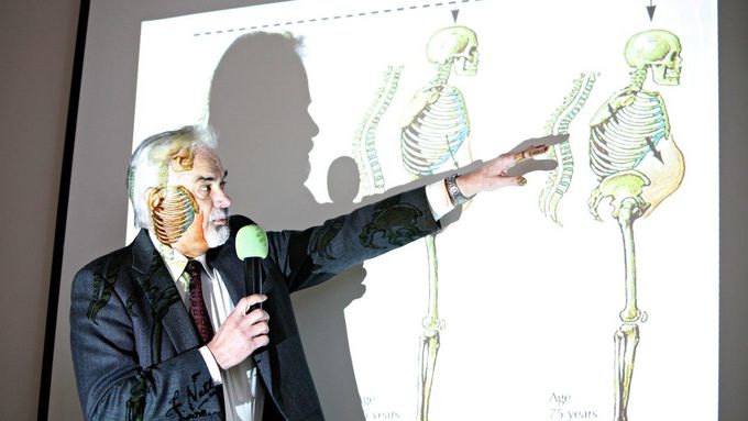 Vladimír Palička z Lékařské fakulty Univerzity Karlovy v Hradci Králové popisuje pomocí ilustrace průběh onemocnění osteoporózou (archivní snímek)
