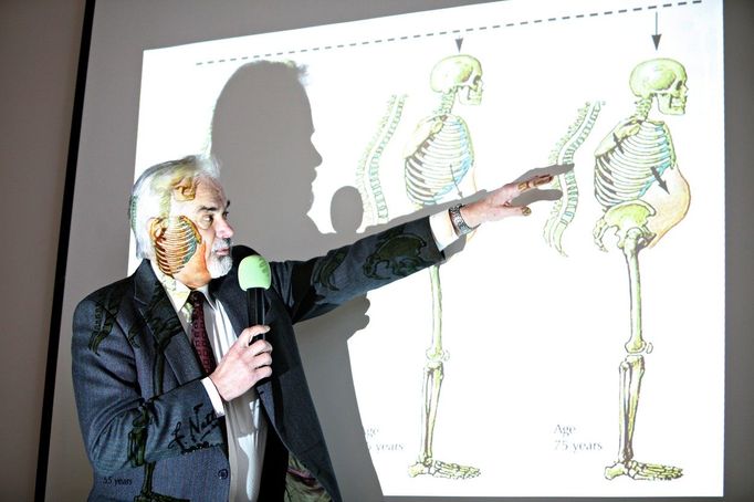 Vladimír Palička z Lékařské fakulty Univerzity Karlovy v Hradci Králové popisuje pomocí ilustrace průběh onemocnění osteoporózou (archivní snímek)