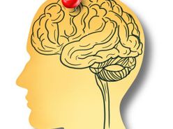 Alzheimer, mozek