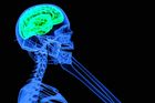 Způsobuje mobil nádory na mozku? Studie míří proti Applu