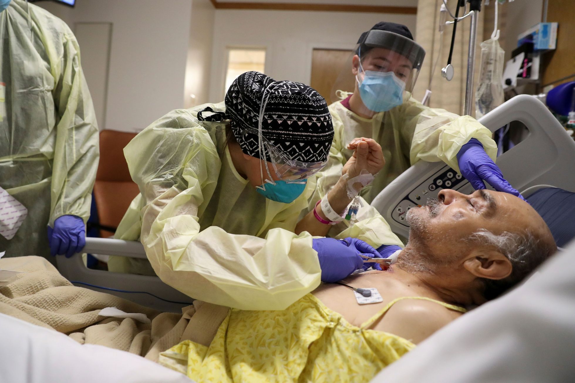 Jednotka intenzivní péče v Los Angeles a muž nakažený koronavirem.