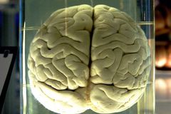 Z univerzity v Texasu zmizela stovka mozků